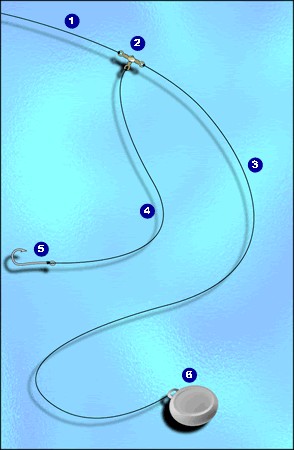 ligne dérivante (source figure ex-atoutmer)