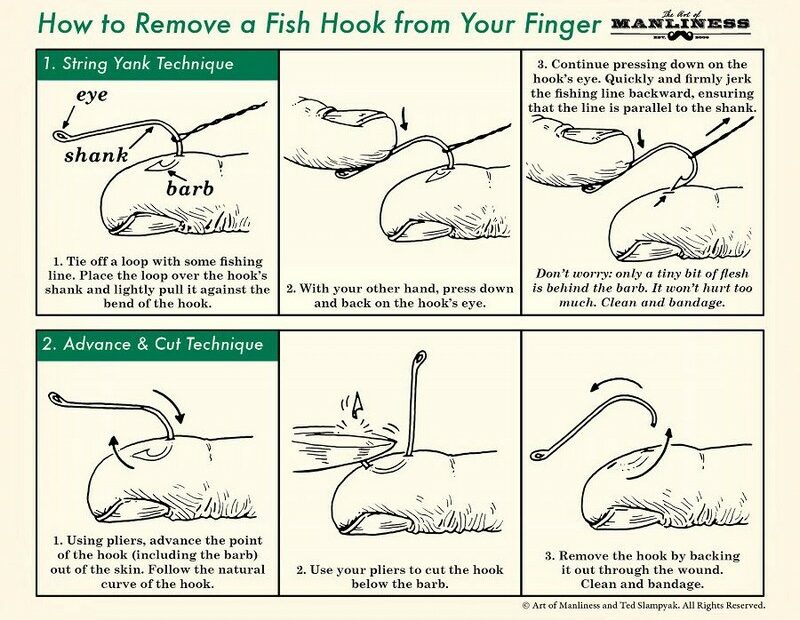 how to remove fish hook from your figer