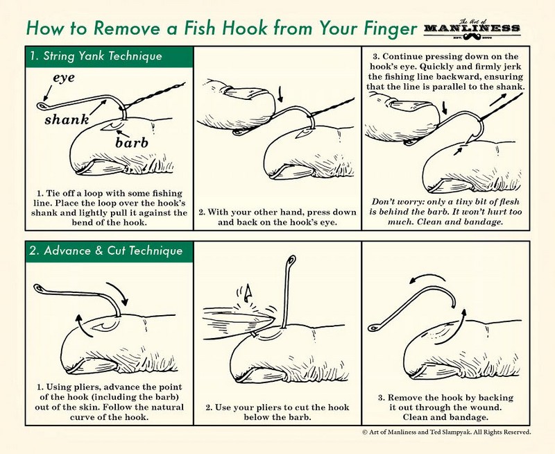 how to remove fish hook from your figer